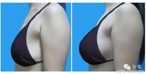 乳神柳岩变成这样，王菲志玲嘉玲纷纷表示不服！