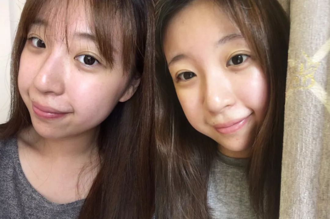 有了这瓶“液体黄金“,今年秋冬注定与干燥、长痘无缘了!