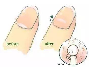 微商胶原蛋白是真的吗,微商胶原蛋白骗局揭秘