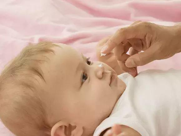 宝宝一到中午就脸红皴裂,天冷小朋友脸皴了怎么办