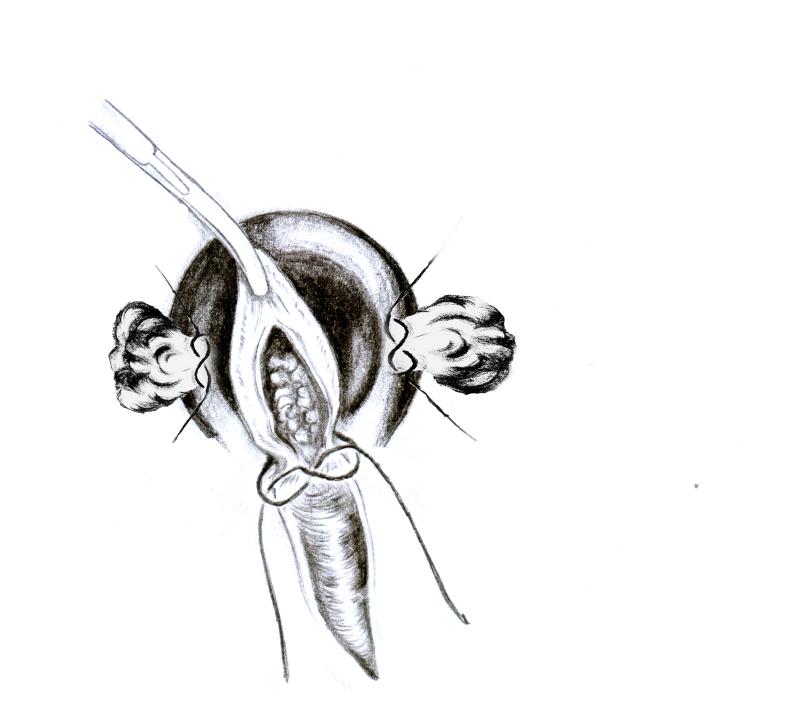 肛肠病诊疗新技术图解,中医肛肠教学