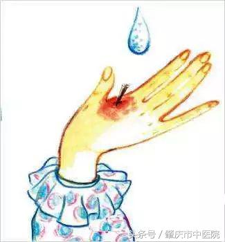 红药水和碘酒有什么区别,碘酒加红药水禁忌图片