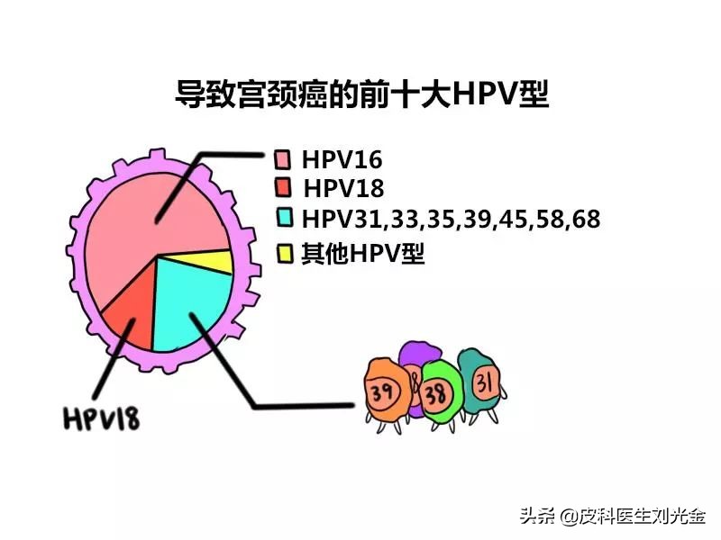 hpv宫颈癌怎么治疗,宫颈癌是hpv持续感染才会得的吗