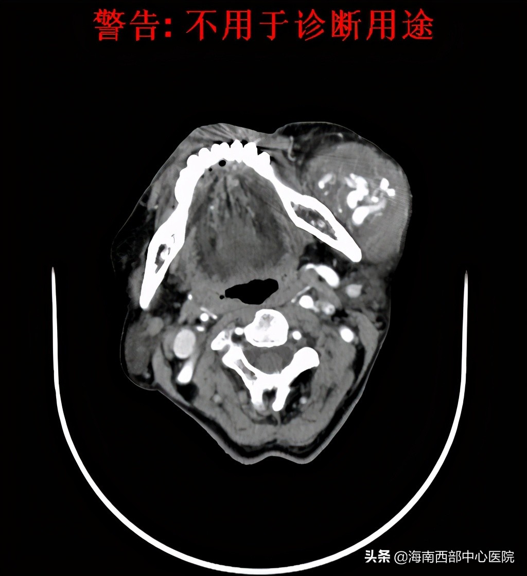 海南西部中心医院进展,海南西部中心医院三期进展