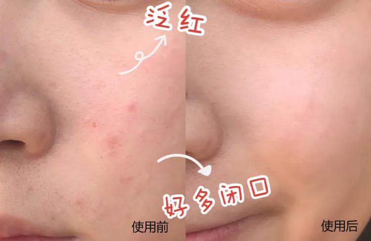 5款零差评口碑爆好的抗皱面霜,澳洲公认最好用的平价面霜