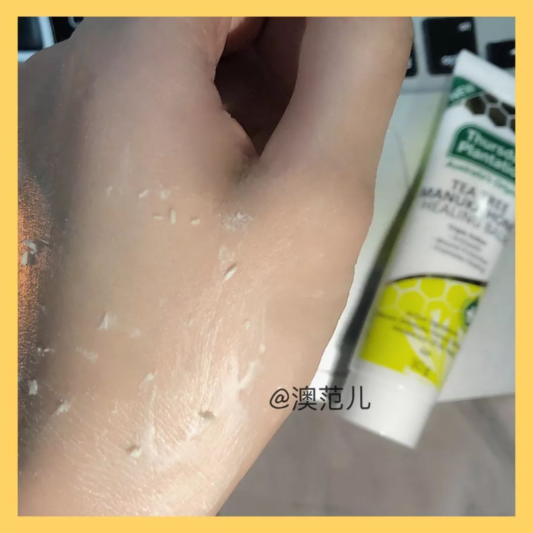 手持挤痘痘神器,挤痘神器单头