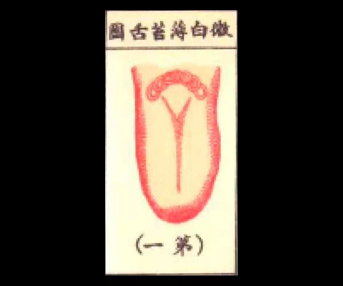 微白薄苔舌、白苔略厚苔舌，此无病之舌，无需用药