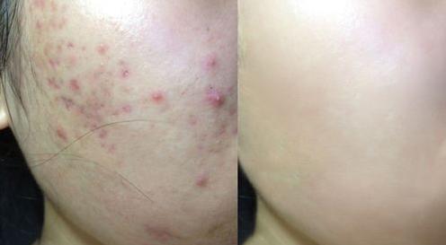 杨幂做了什么医美,杨幂新氧医美