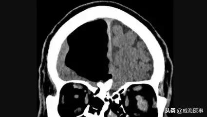 李吉洲：胆大心细，执着创新，“咽喉要道”的守护神
