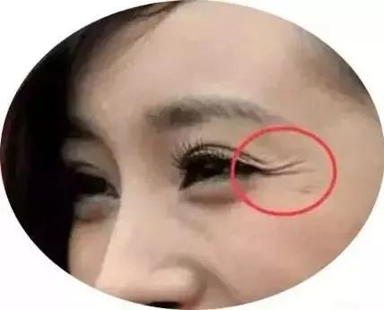 眼纹怎么针对性护理,眼纹的正确用法