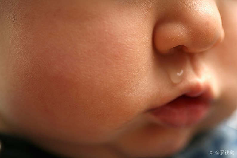 儿童鼻塞美国人怎么通鼻子,缓解儿童鼻塞吸鼻涕的妙招