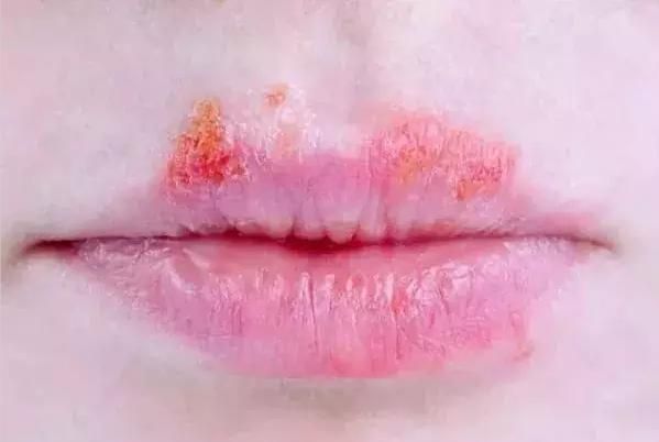 什么牌子的化妆品比马桶脏,专柜买的化妆品有质量问题能退吗