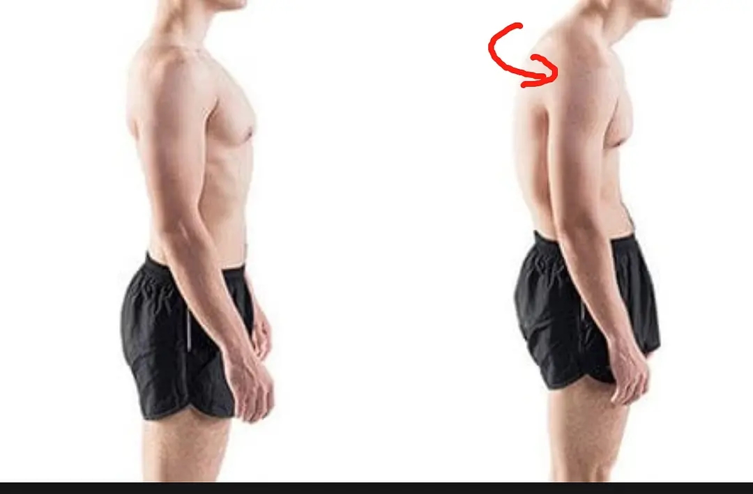 斜方肌太大怎么练视频,斜方肌太大了怎么练哑铃