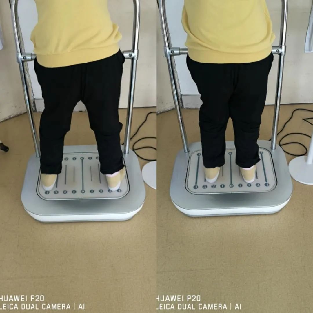 足底筋膜松动术,足底冲击疗法