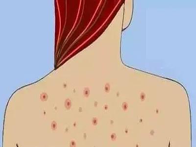 科学表明体毛真的会越刮越少吗,身上的体毛会越刮越多吗