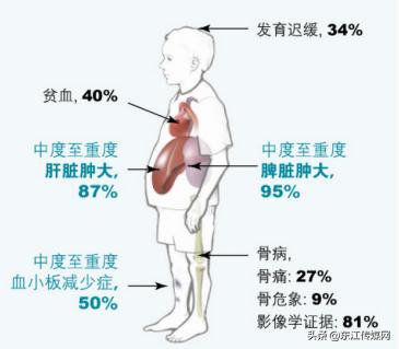 一年医药费上百万,一年医药费三万多