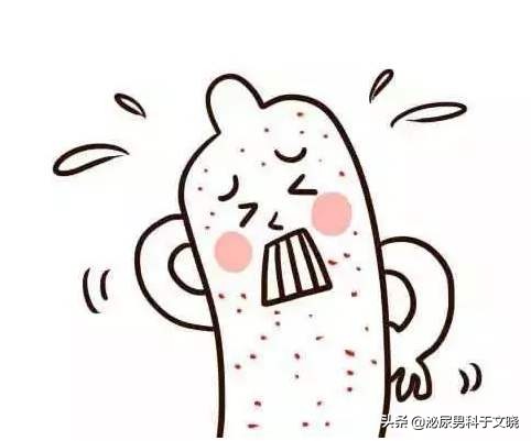 男子尿急流脓是怎么回事,男性尿痛流脓吃药好了反复