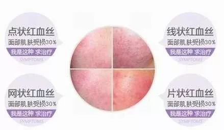 紫檀真的抗衰老吗,紫檀能扩香吗