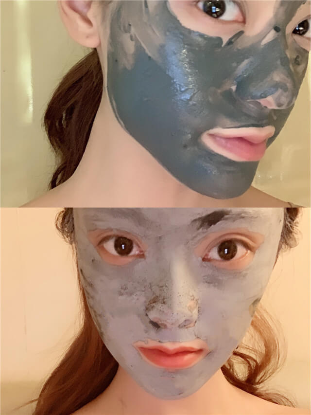 脸上有痘痘怎么护理才好上妆,下巴脸颊两边反复长痘痘怎么护肤