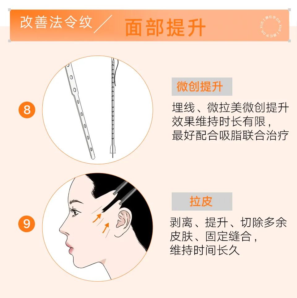 脾胃好了法令纹会改善吗,面部瑜伽能改善法令纹吗