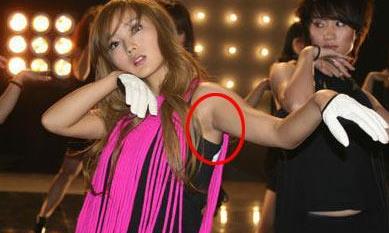 女性腋毛旺盛究竟是好事还是坏事,女性腋毛多会影响备孕吗