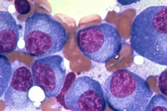 钙剂有什么品种,钙剂什么类型的药