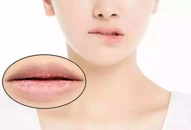 红霉素软膏的作用对痘痘有什么用,红霉素软膏作用与功效能治脚气吗