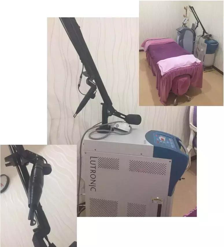 医美祛眼袋分享,医美分享案例