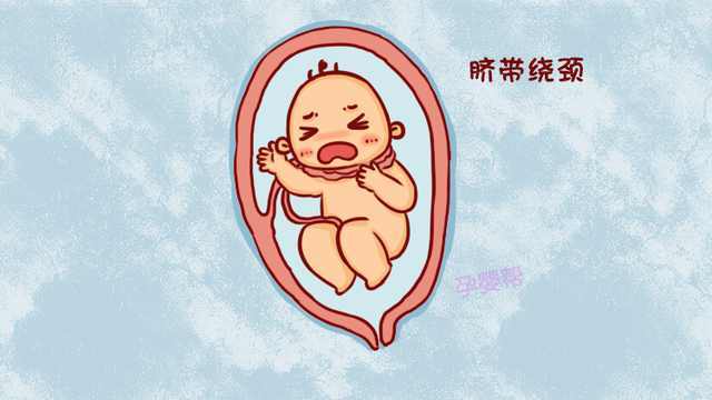 孕38周检查脐带绕颈一周,怀孕30周b超双顶径7.2偏小吗