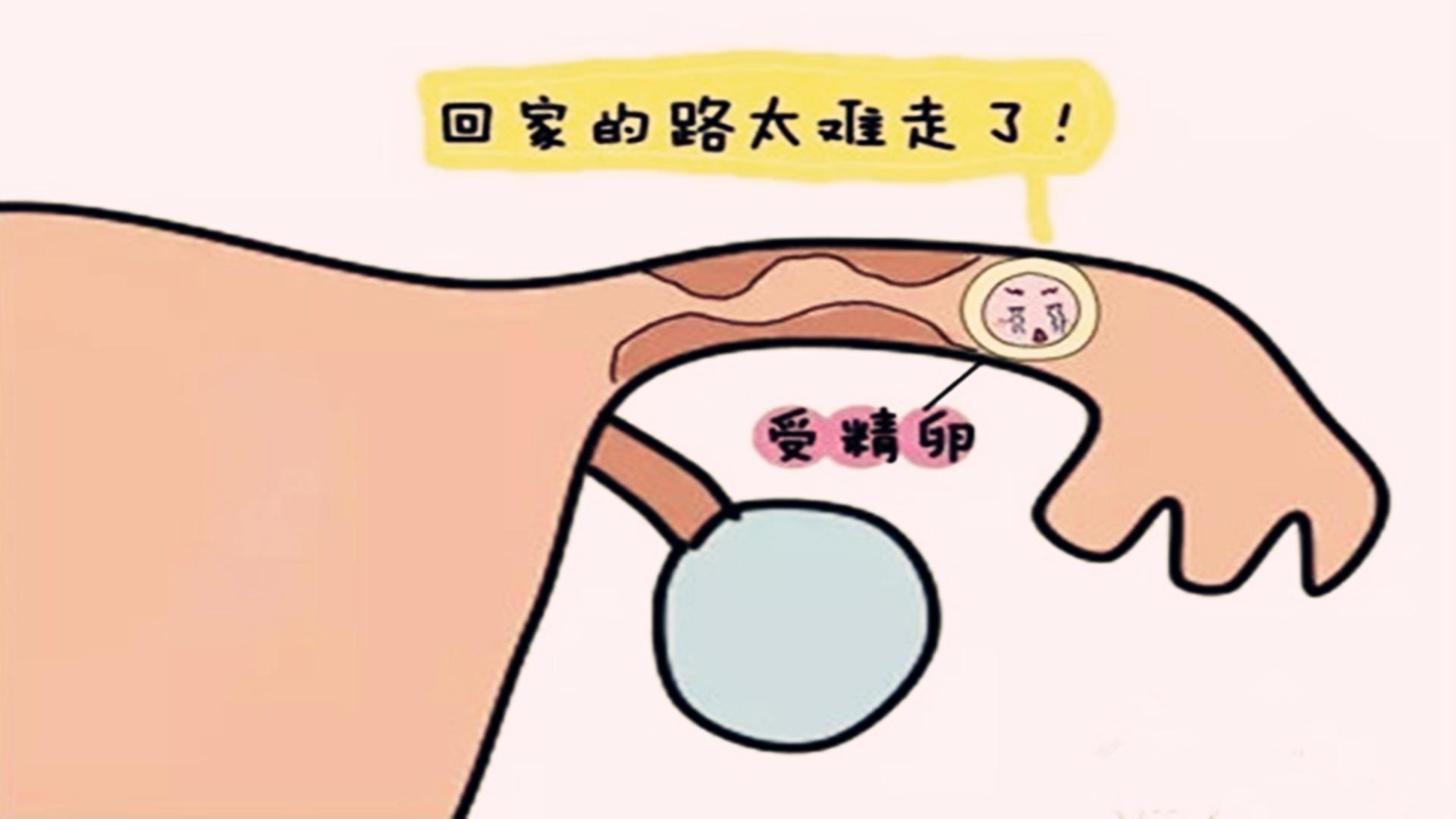 如何判断是否属于宫外孕?这几种症状表现最明显,你都了解吗