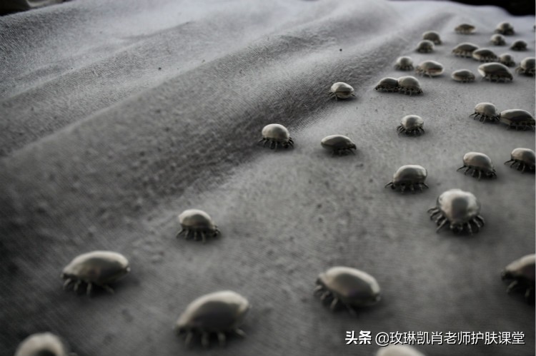 螨虫感染皮肤的症状如何去除,全身被螨虫咬怎么解决