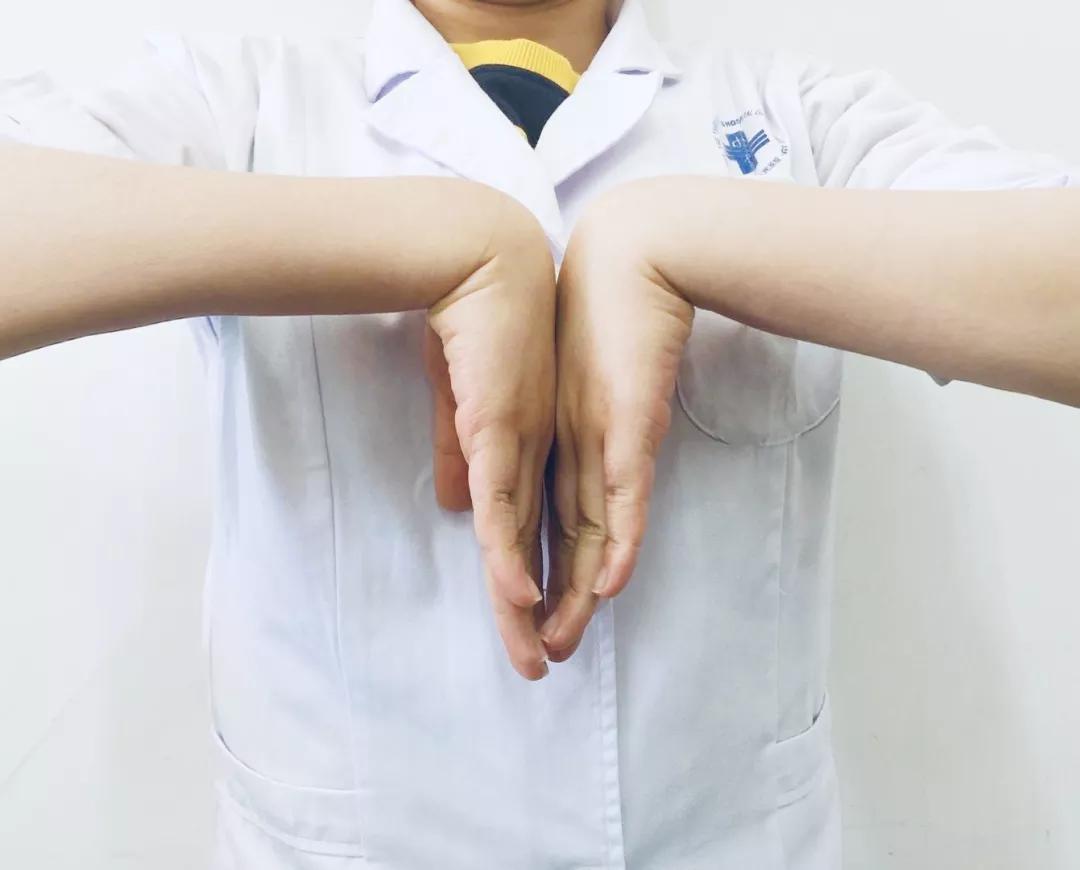 女子出现手麻,拖延1年后就医,手掌这地方已“瘪”掉!年轻人易中招