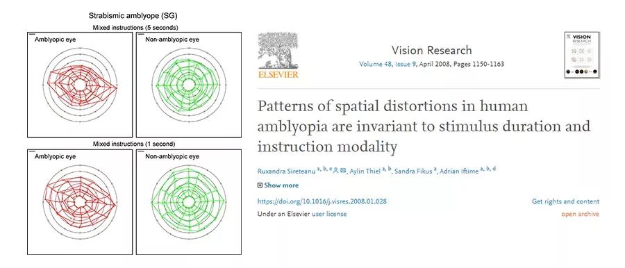 四个方法帮你解决弱视的困扰,弱视治疗小技巧