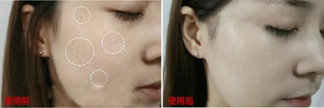 怎样敷水光面膜,明星每天敷面膜