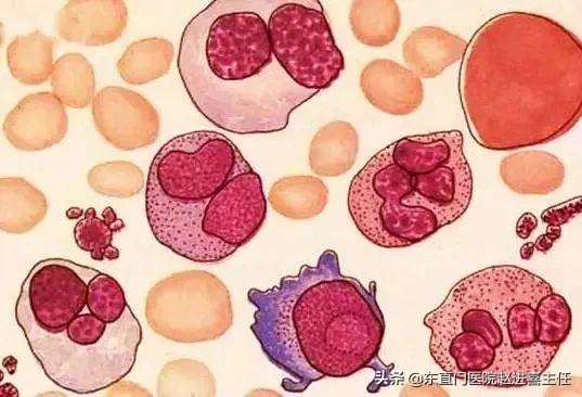 紫癜性肾炎中药调理,紫癜肾炎中药调理可以吗