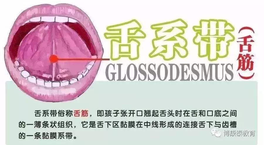 博康泰丨剪舌筋：该不该让孩子挨这一刀？