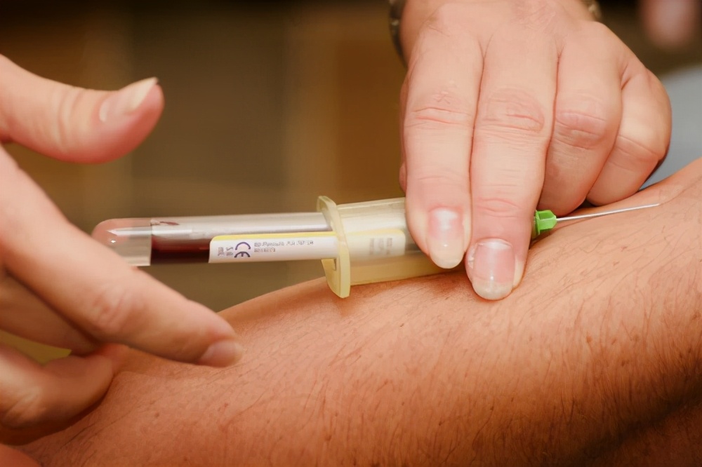 如果怀疑被感染艾滋怎么预防,高危后多久可以排除艾滋病感染