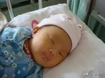 出生6天的婴儿黄疸高怎么办,为什么新生儿有黄疸要换血