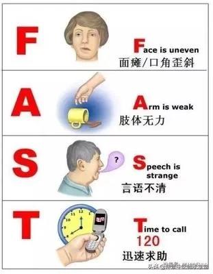 治疗中风后遗症的方子,治疗中风后遗症最好处方