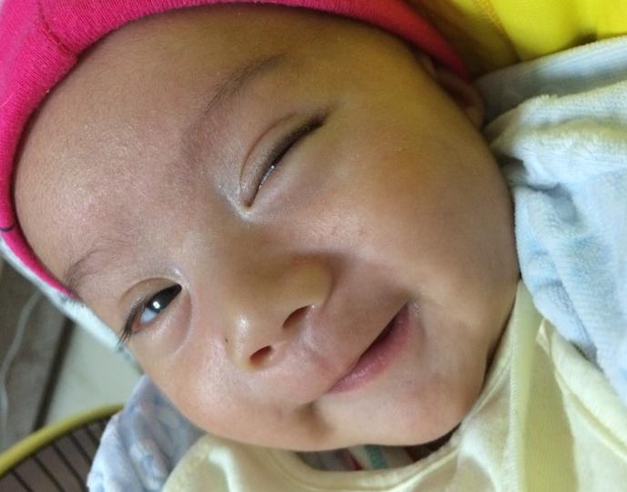 宝宝眼睛疼警惕四种疾病,7个月宝宝眼睛发红该怎么办