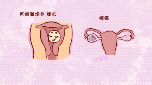 预防妇科炎症的诀窍有哪些?妇科炎症不治会自己痊愈吗?