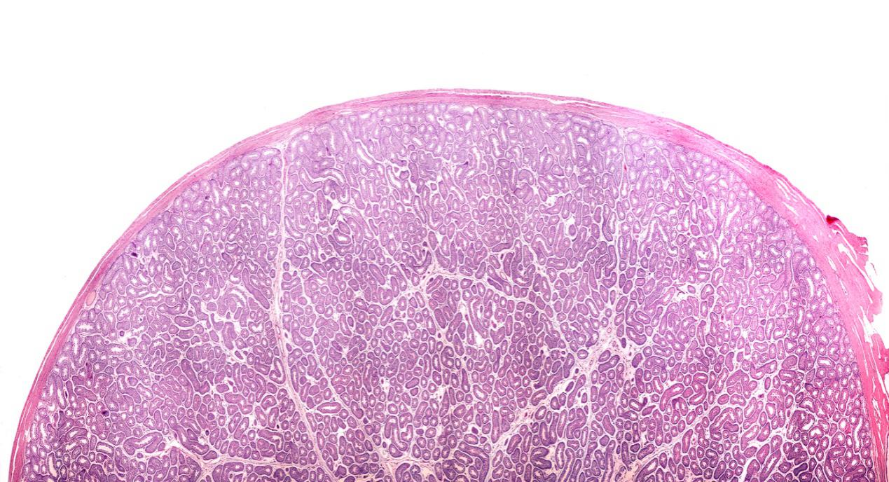 害怕蛋蛋受伤生不了娃？“拆蛋专家”表示问题不大！