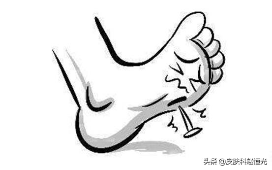 脚上长了一个类似鸡眼但不是鸡眼,脚上长了类似鸡眼是什么