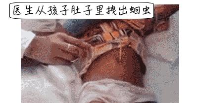 2个娃身上突然多处淤青，到底是谁虐的？