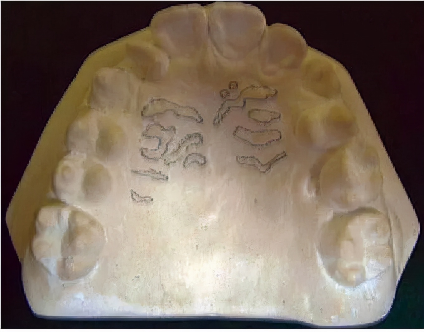 口腔内壁凹凸不平图片,口腔内壁凹凸不平褶皱