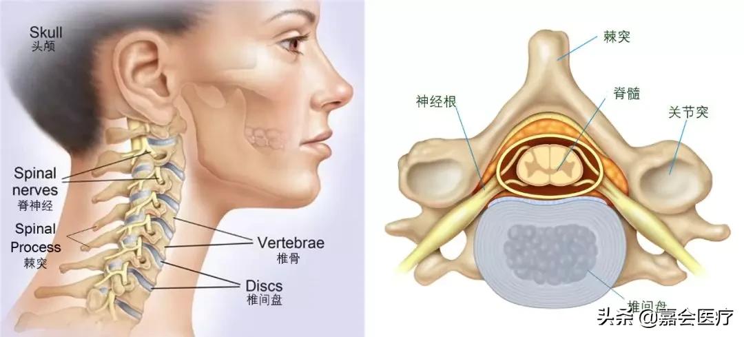 颈痛的煎熬，你不是一个人在承受