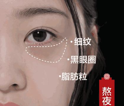 “睡渣”也能神采奕奕，修仙*党**们都用什么解决缺觉难题？