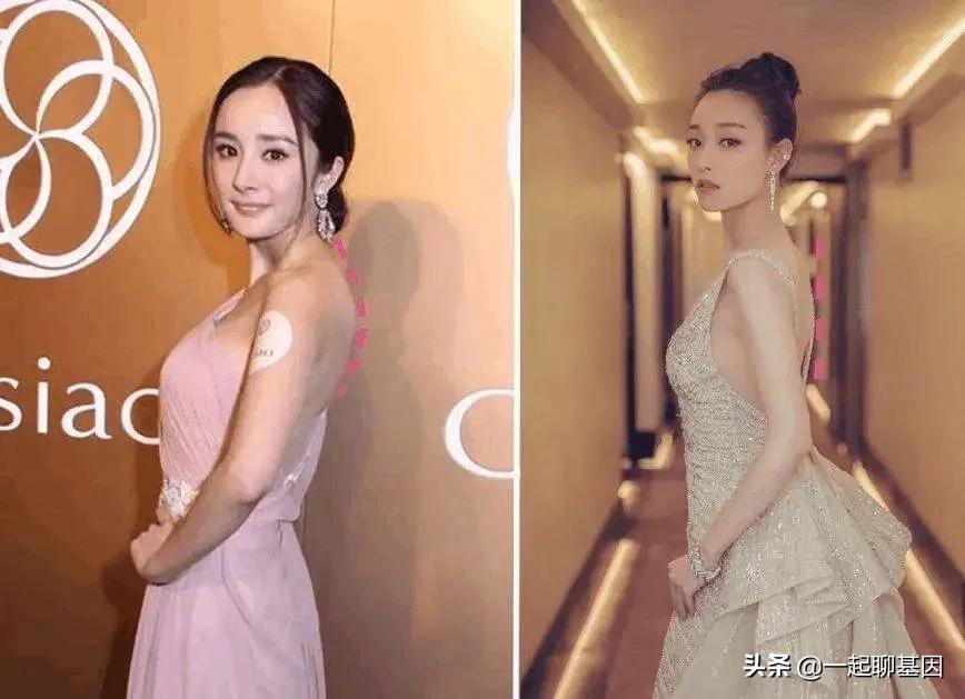 驼背如何矫正最快最有效方法,驼背怎么办最有效的方法