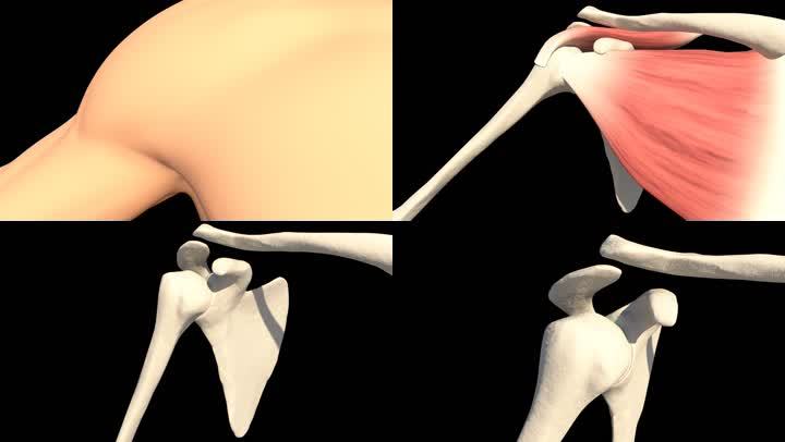 肩关节脱位复位用什么药,肩关节脱位复位后怎么治疗