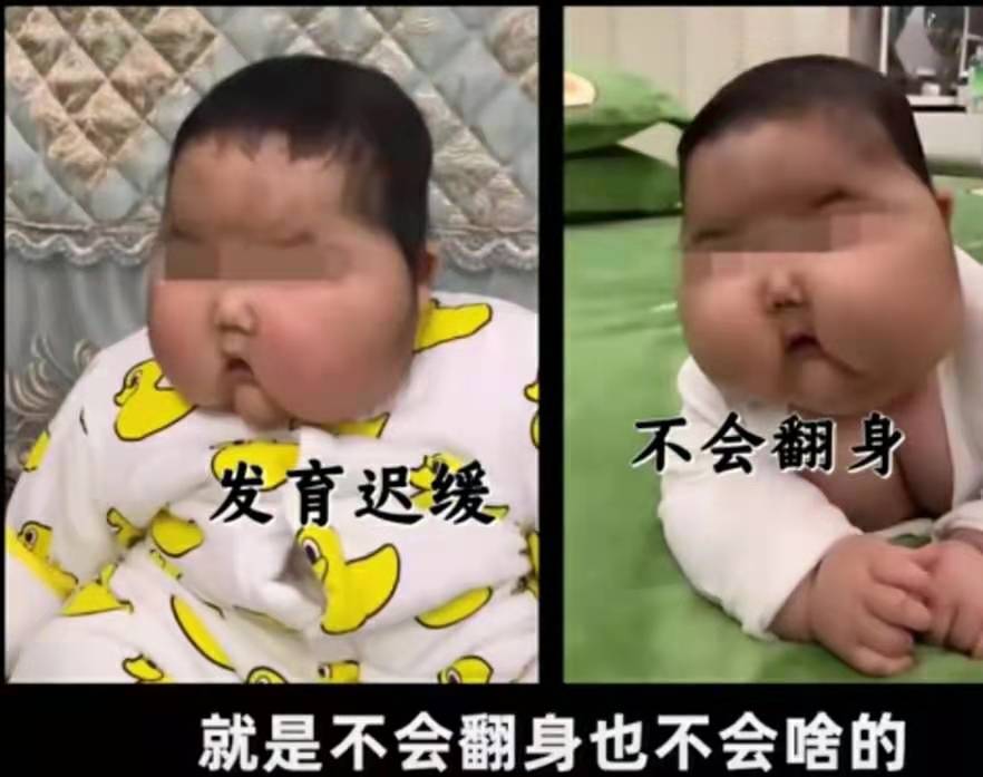 用婴儿面霜额头会长毛吗,婴儿六个月额头上长汗毛